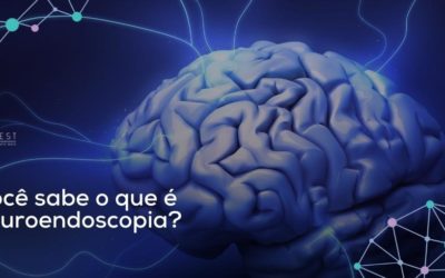 Você Sabe o que é Neuroendoscopia?